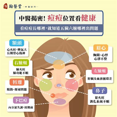 痘痘長得位置|青春痘、下巴痘痘長這個位置代表什麼意思？先弄懂長。